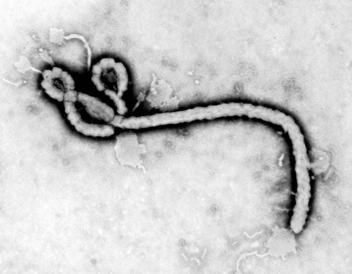 Transmission electron micrograph of Ebola virus by Frederick Murphy, CDC PHIL #1181.